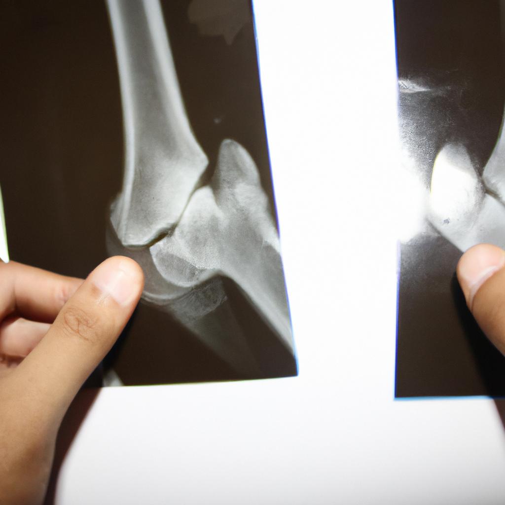 Person examining X-ray of joint